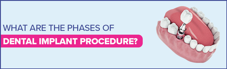 what are the phases of dental implant procedure