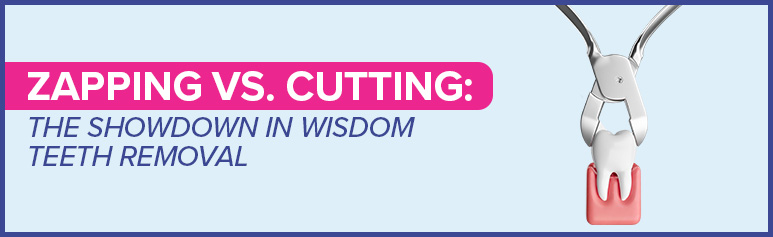 zapping vs cutting in wisdom teeth removal