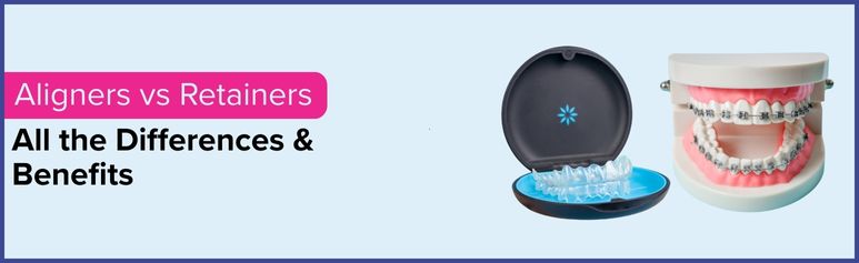 aligners vs retainers diff