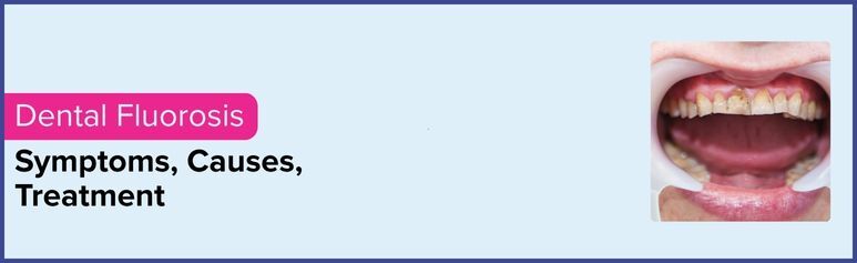 dental clinic in chennai