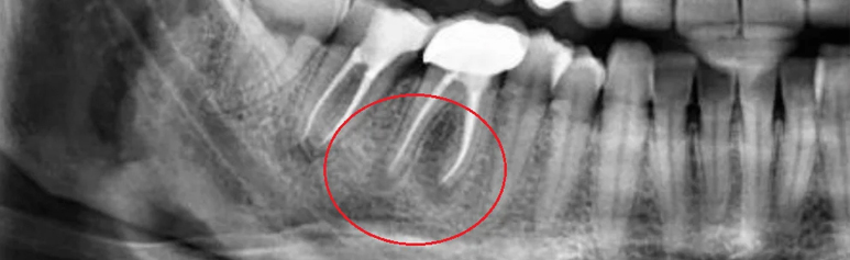 dental clinic in chennai