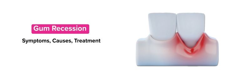 dental clinic in chennai