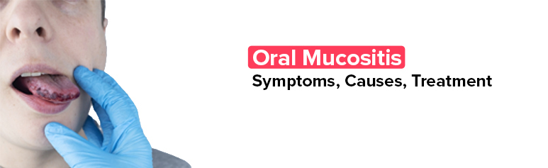 best dental clinic in chennai