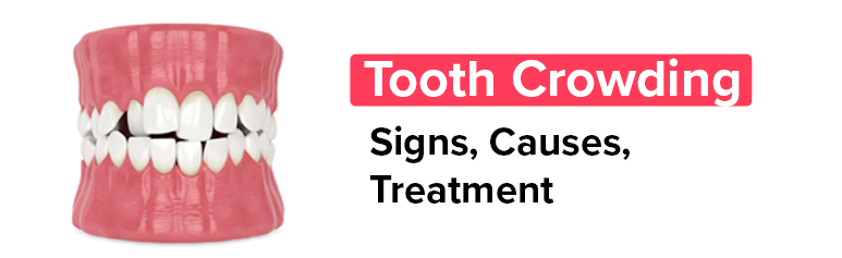 best dentist in chennai