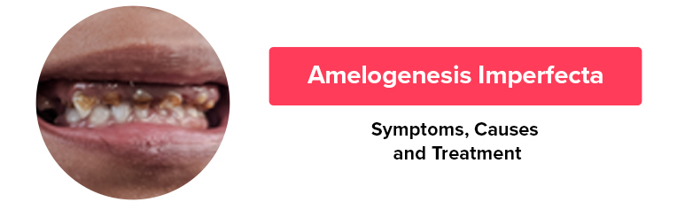 best dental hospital in chennai