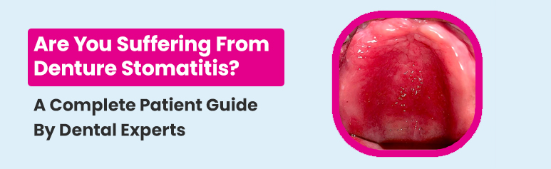 suffering from denture stomatitis