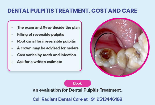 dental pulpitis treatment cost
