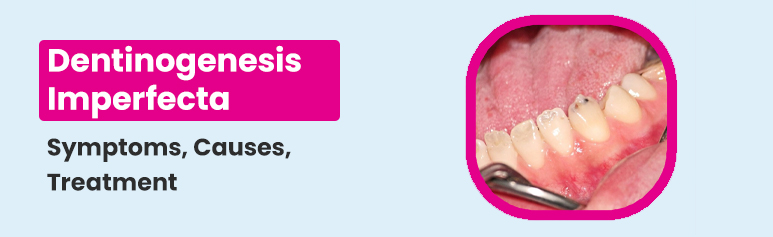 dentinogenesis imperfecta treatment