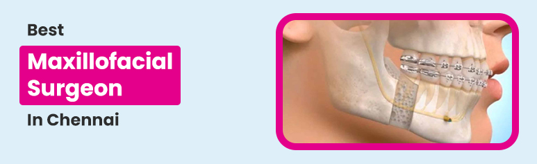 best maxillofacial surgeon chennai