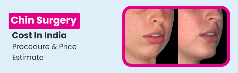 chin surgery cost india