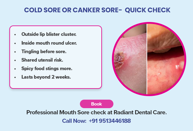 cold sore or canker sore quick check