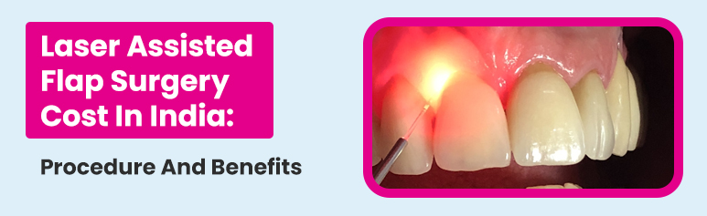 laser assisted flap surgery cost