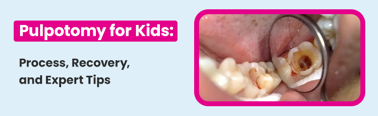 pulpotomy for kid