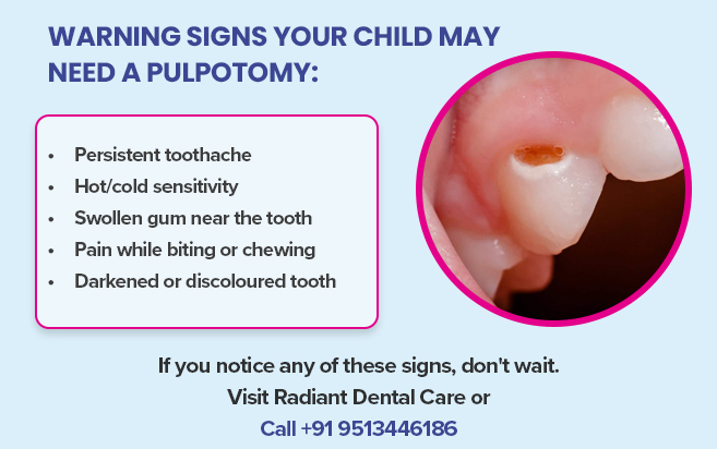warning signs your child may need a pulpotomy