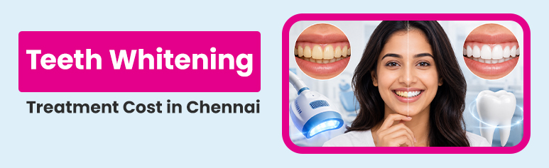 teeth whitening treatment cost in chennai
