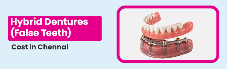 hybrid dentures cost in chennai