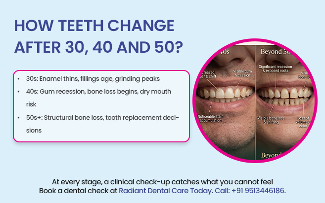 how teeth change after 30, 40 and 50