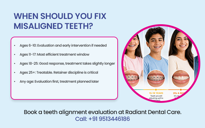 when should You fix misaligned teeth