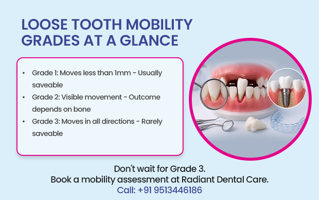 loose tooth mobility grades at a glance