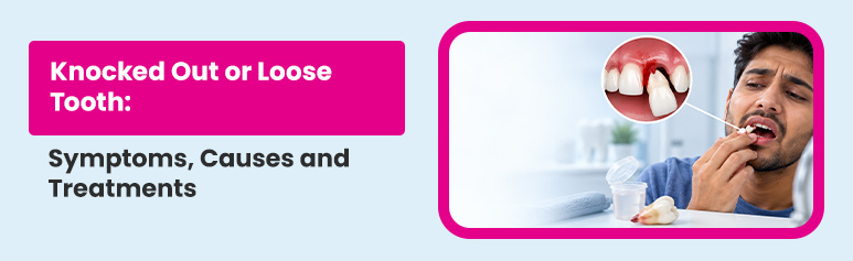 1 knocked out or loose tooth- symptoms, causes and treatments