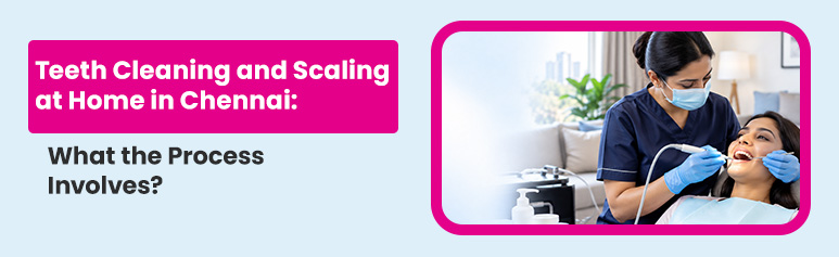 teeth cleaning and scaling at home in chennai- what the process involves