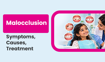 malocclusion: symptoms, causes and treatment