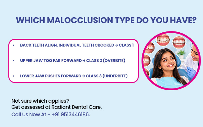 which malocclusion type do you have?
