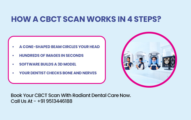 how a CBCT Scan works in 4 Steps?