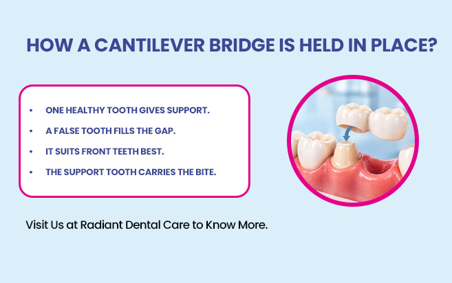 how a cantilever bridge Is Held in place?
